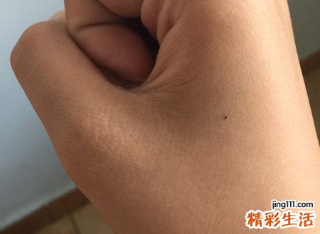 女人右手背有痣好不好