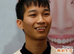 男人牙齿不齐面相