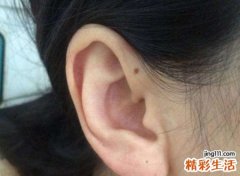 靠近耳根位置长痣好不好