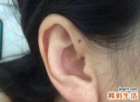 靠近耳根位置长痣好不好