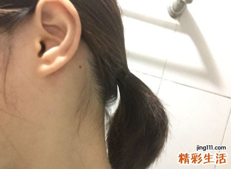 耳后有痣是富贵痣吗