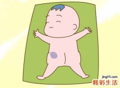 屁股上有胎记好吗