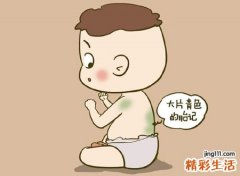 后背胎记的位置与命运