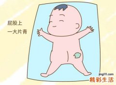 屁股胎记寓意着什么