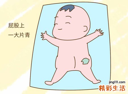 屁股胎记寓意着什么