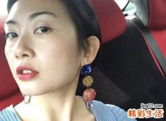 痣多的人好不好