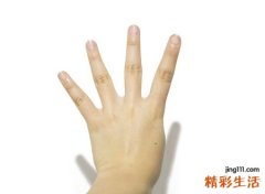 手背长痣代表什么