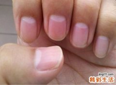 手指月牙代表什么