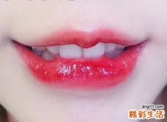 上唇短必是短命人