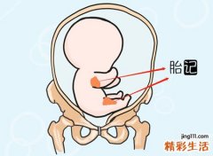 胎记的位置与命运