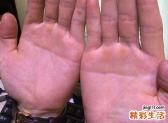 双手断掌的男人命苦