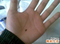 手掌痣的位置与命运