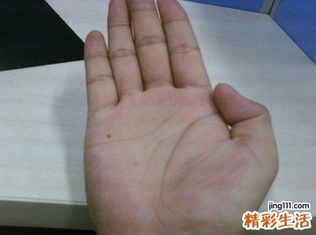 手掌长痣代表什么