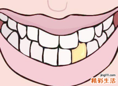 梦见牙齿掉了一颗好不好，做梦梦到牙齿掉了流血了