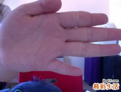 生命线断开错位又延伸代表什么