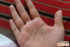 小拇指很短的人命运如何?有什么特点？