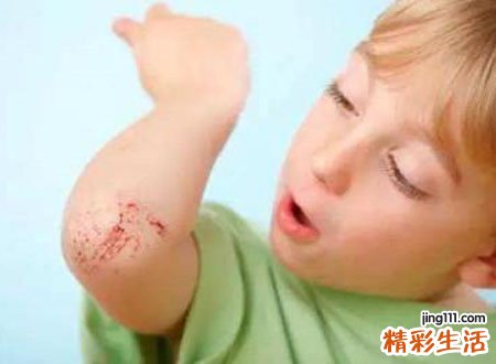 梦见别人身上有血好不好，女人梦见别人满身是血