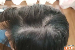 女人头发少是旺夫相吗 旺夫命的女人有哪些特点