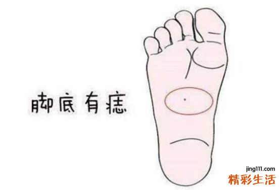 左脚脚底有痣代表什么意思 左脚脚底有痣好吗