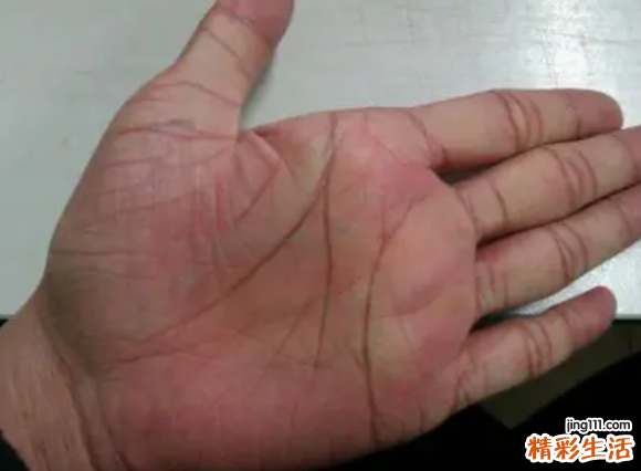手相中的吉祥纹有哪些 非常难得的十大吉祥手相