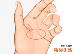 手痣的位置代表什么意思 手痣的位置与命运图大全