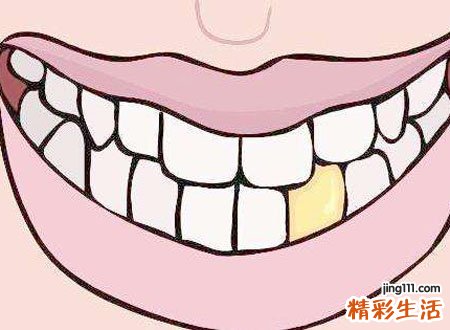孕妇梦见门牙掉了好吗，孕妇梦见上门牙掉了一颗