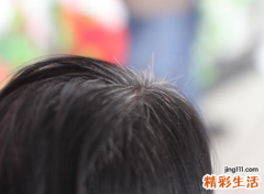 梦见白头发好不好，做梦梦到一觉醒来自己长白头发了