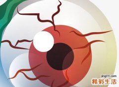 梦见死人又死了预示什么，做梦梦到去世的人又办丧事