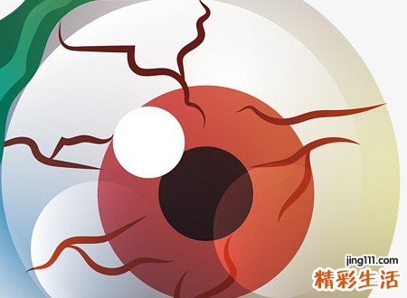 梦见死人又死了预示什么，做梦梦到去世的人又办丧事
