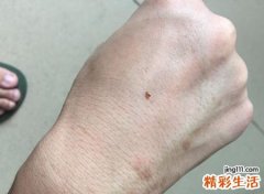 梦见虱子是什么预兆，女人梦见床上好多虱子