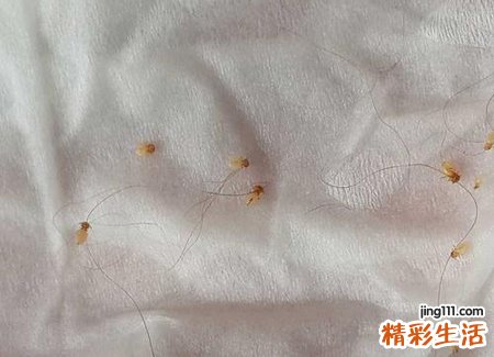 梦见亲手掐死虱子意味着会发财致富吗