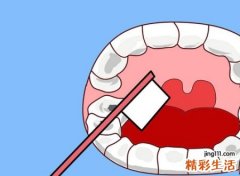 梦到牙齿松动大量脱落，做梦梦见牙齿松动是什么意思