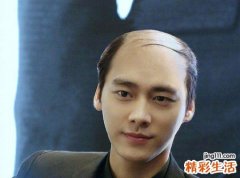 梦见我头顶中间秃了变成秃顶