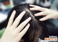 梦见生气抓头发掉了一大把头皮发麻