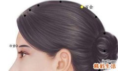 失眠针灸哪里最好 失眠针灸治疗方法