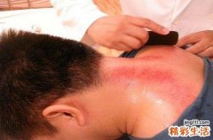 刮痧对失眠有帮助吗 睡眠不好刮痧图示