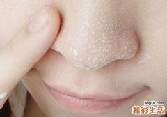 常见的排毒食物有哪些 常见排毒食物排行榜
