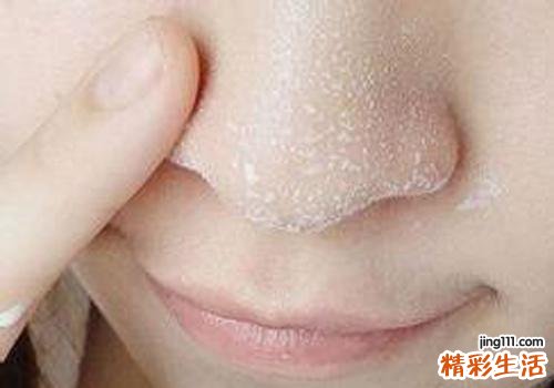 常见的排毒食物有哪些 常见排毒食物排行榜