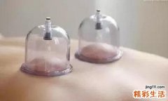失眠拔罐在什么部位 失眠拔火罐哪个位置图
