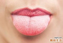 坐月子口臭怎么办
