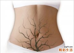 肠道排毒的最好方法 这样做对肠道好