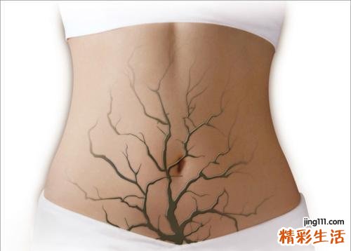 肠道排毒的最好方法 这样做对肠道好