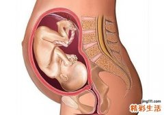孕妇补钙会不会导致胎盘老化
