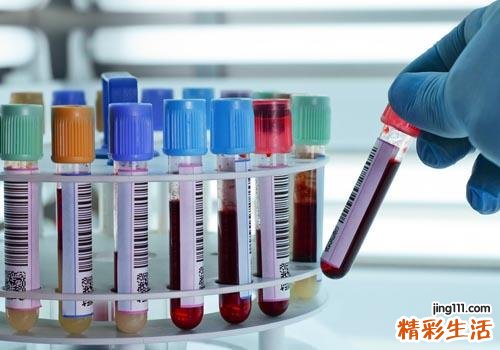 抽血后吃什么补血快 这些食物助你快速恢复元气