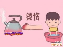 儿童烫伤应怎么处理 儿童烧烫伤八成五在家发生！家长要注意这些