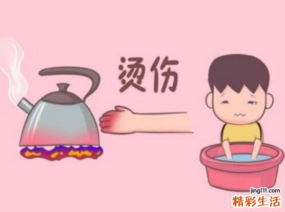 儿童烫伤应怎么处理 儿童烧烫伤八成五在家发生！家长要注意这些