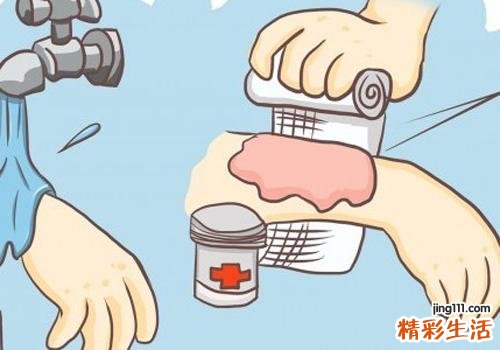 夏天，如何正确应对小孩烫烧伤 小孩烫伤怎么办
