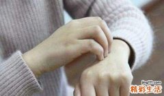 荨麻疹是什么引起的 荨麻疹的危害性