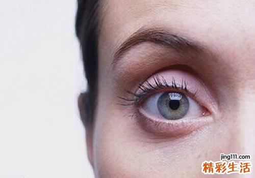 下眼袋水肿是什么原因 下眼袋水肿怎么办
