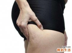 夏天水肿怎么办 夏天水肿的原因是什么